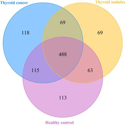 Saliva microbiome changes in thyroid cancer and thyroid nodules patients